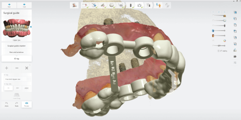 Implant Studio