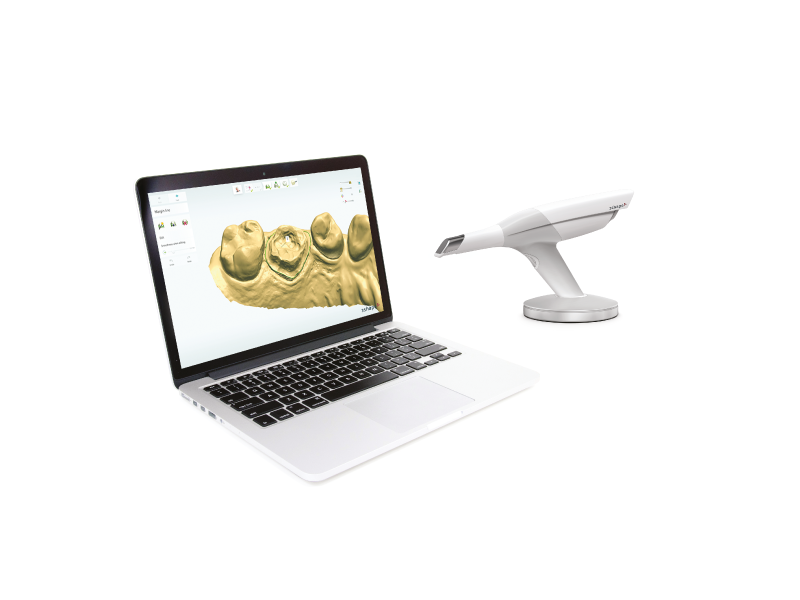3Shape TRIOS Design Studio szoftver futtatása laptopon mellette TRIOS intraorális szkennerrel