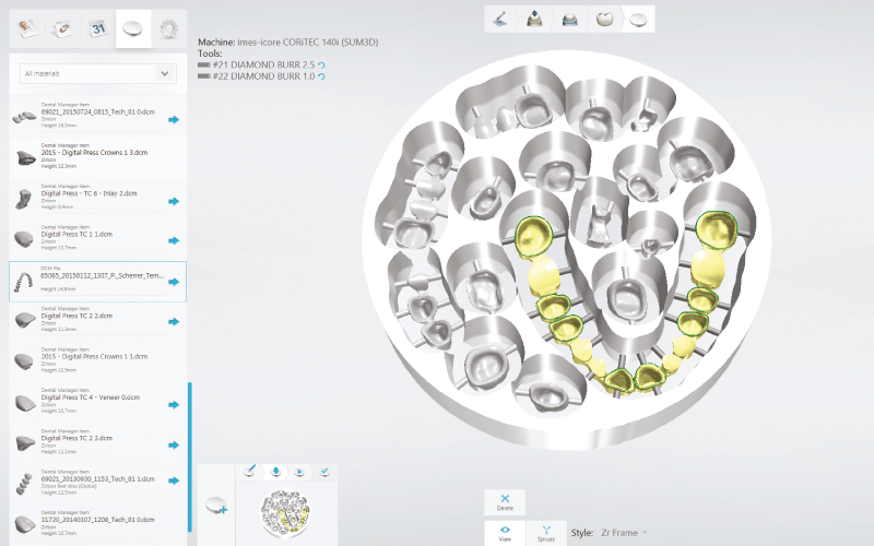 3Shape Dental System tervezőszoftver