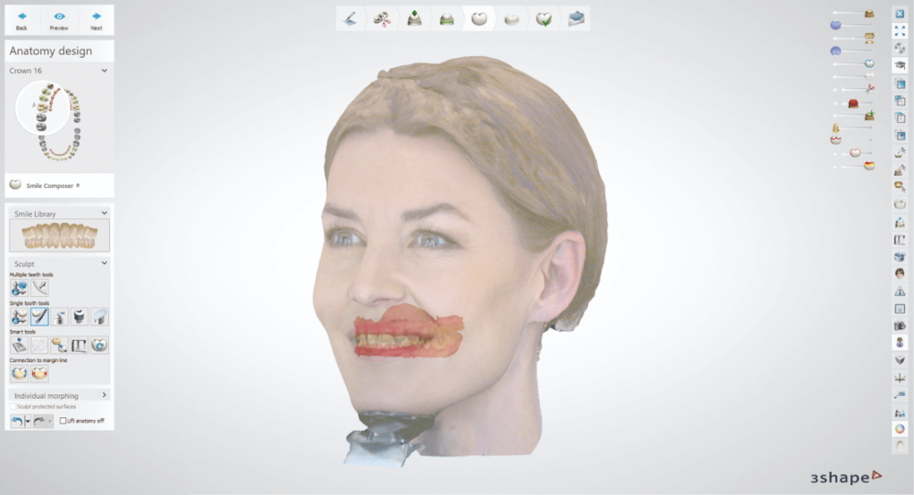 3Shape Dental System szoftver