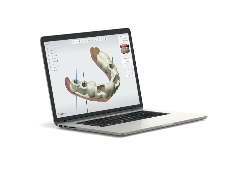 3Shape Implant Studio futtatása laptopon