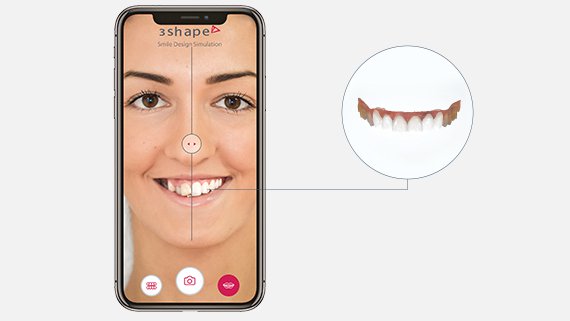 Smile Design mosolytervező szoftver