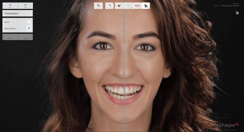 Smile Design