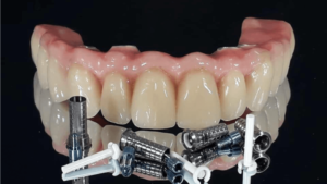 OT-Bridge
