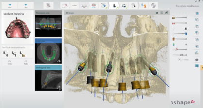 3Shape Dental System