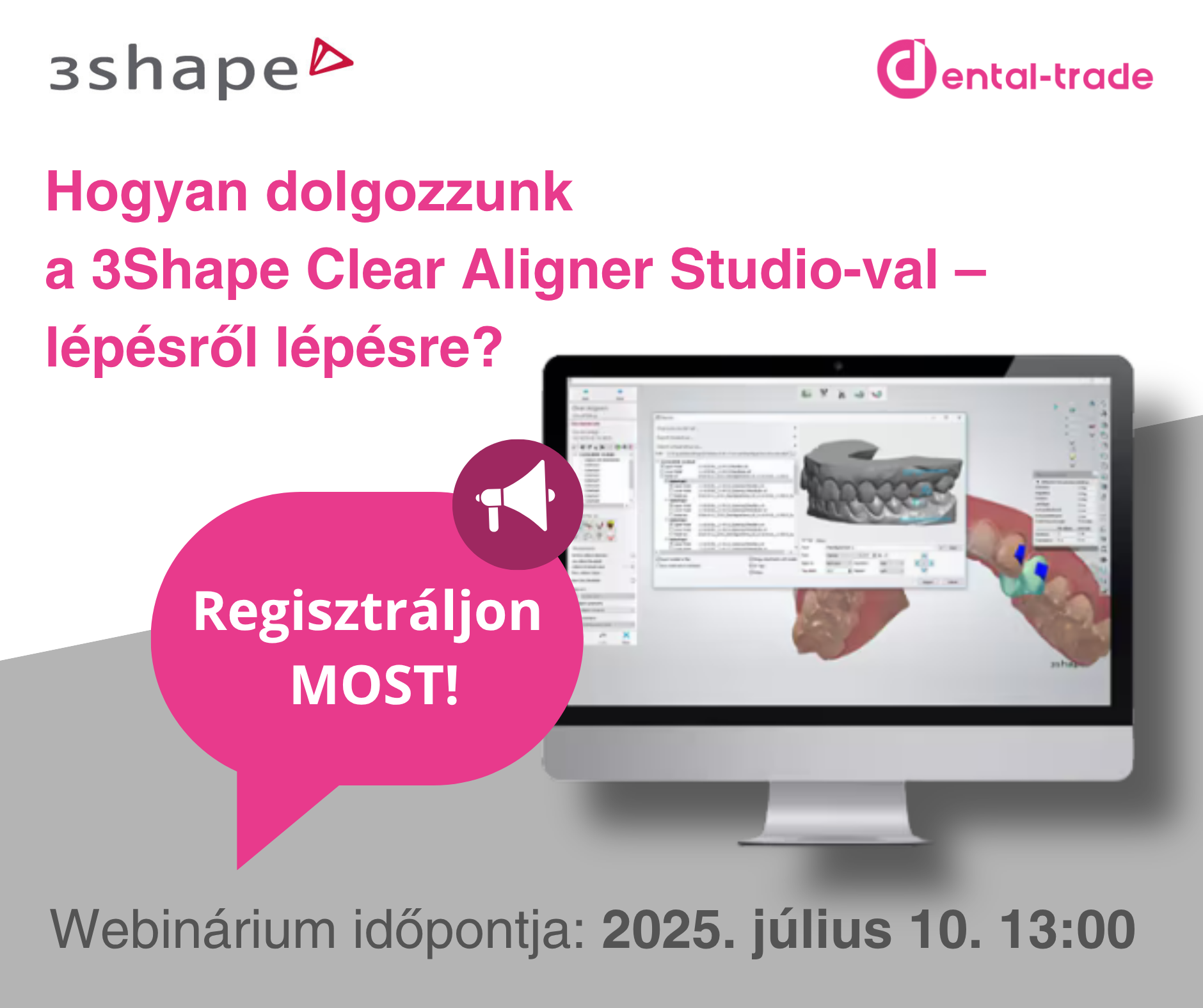 3shape clear aligner ingyenes workshop
